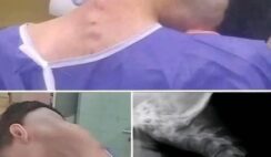 Young man hospitalized because he dropped his ca… See more